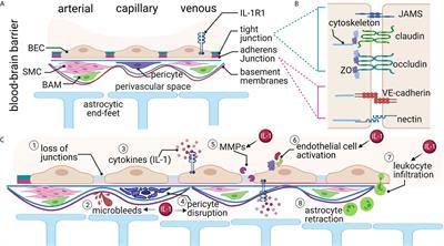 Inflammatory Regulation of CNS Barriers After Traumatic Brain Injury: A Tale Directed by Interleukin-1